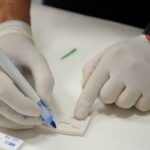 Hepatite B terá notificação compulsória para gestantes