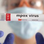 OMS estima custo de US$ 135 milhões em 6 meses para conter mpox