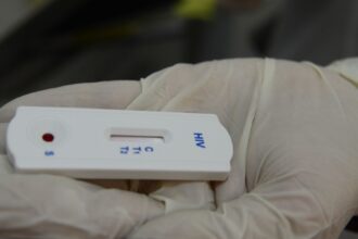 Saúde orienta farmácias sobre testes para HIV, sífilis e hepatites