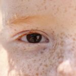 Campanha de conscientização sobre retinoblastoma começa hoje