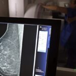 Cerca de 77 mil mulheres aguardam mamografia pelo SUS