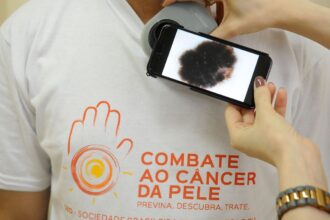 Mutirão atende população hoje, no dia de combate ao câncer de pele