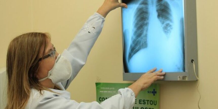 Brasil está na contramão da meta da OMS para extinção da tuberculose