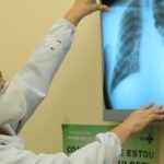 Baixo financiamento mundial ameaça combate à tuberculose