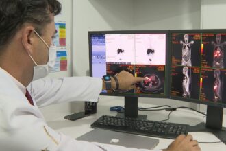 Rastreamento de câncer de intestino identifica lesões em 231 pacientes