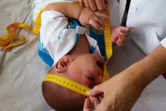 INSS pagará indenização de R$ 60 mil a crianças vítimas de zika