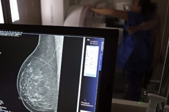 Câncer de mama: uma em cada três pacientes tem menos de 50 anos