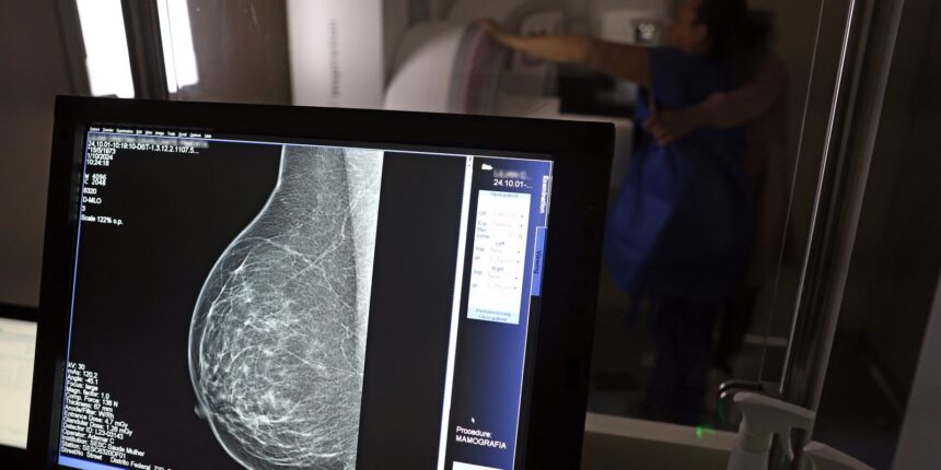 Câncer de mama: uma em cada três pacientes tem menos de 50 anos