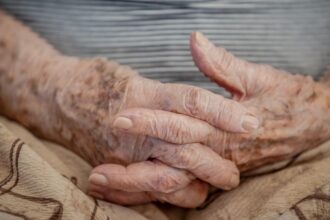 Demência em idosos hospitalizados é despercebida em até 50% dos casos