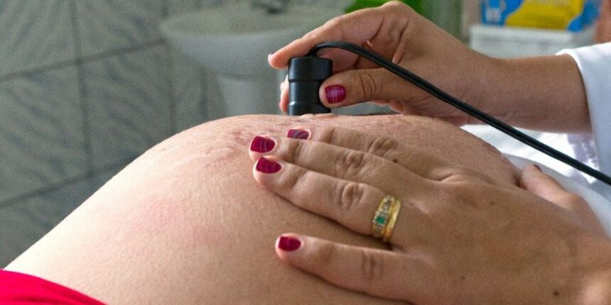 Exame pré-natal reduz chance de bebê nascer com anomalia