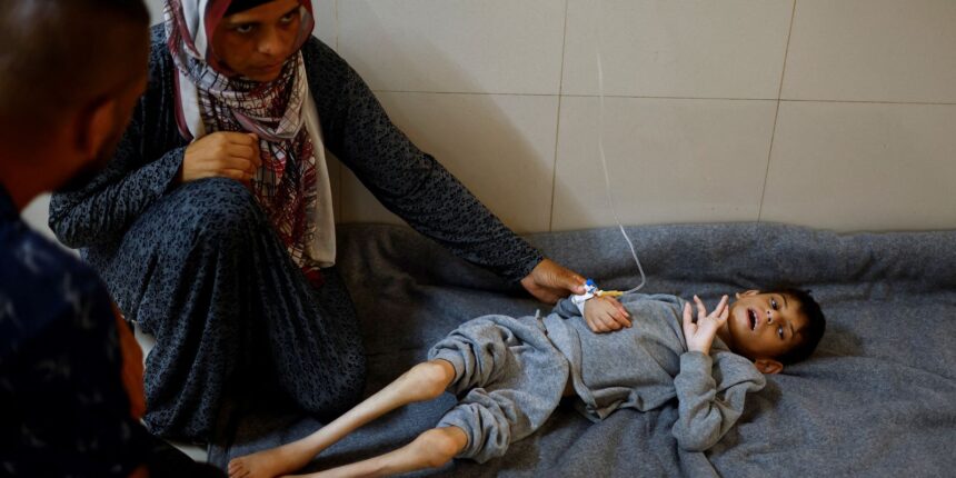 FAO aponta que fome chegou a pior patamar em Gaza