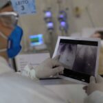 Broncopneumonia: entenda quadro que causou internação de Bolsonaro