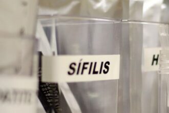 Centro de SP tem testagem grátis de HIV, hepatite, síflis e gonorreia