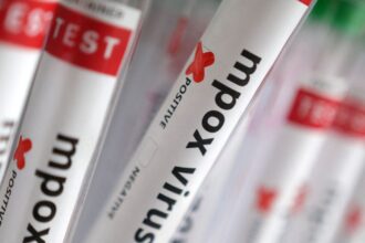 Sobe para 140 número de casos confirmados de Mpox no país, em 2026