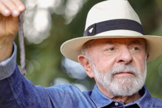 Lula vai a SP para tirar excesso de pele na cabeça e tratar tendinite