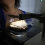 ANS defende que plano cubra mamografia digital sem restrição de idade