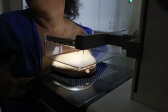 ANS defende que plano cubra mamografia digital sem restrição de idade