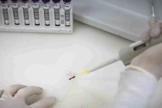 Exames descartam ebola em imigrante da República Democrática do Congo