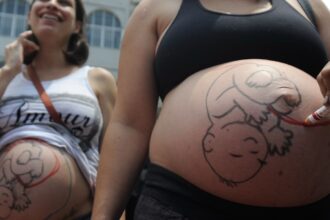 Fatores sociais e estruturais empurram mulheres para cesarianas
