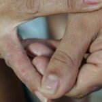 Dermatite atópica impacta pele, sono e autoestima: saiba como tratar