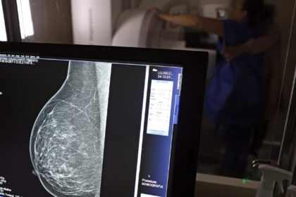 Entidades alertam médicos sobre pedidos de mamografia digital